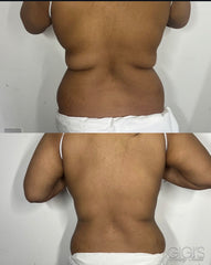 360 Non-Invasive Body Contouring