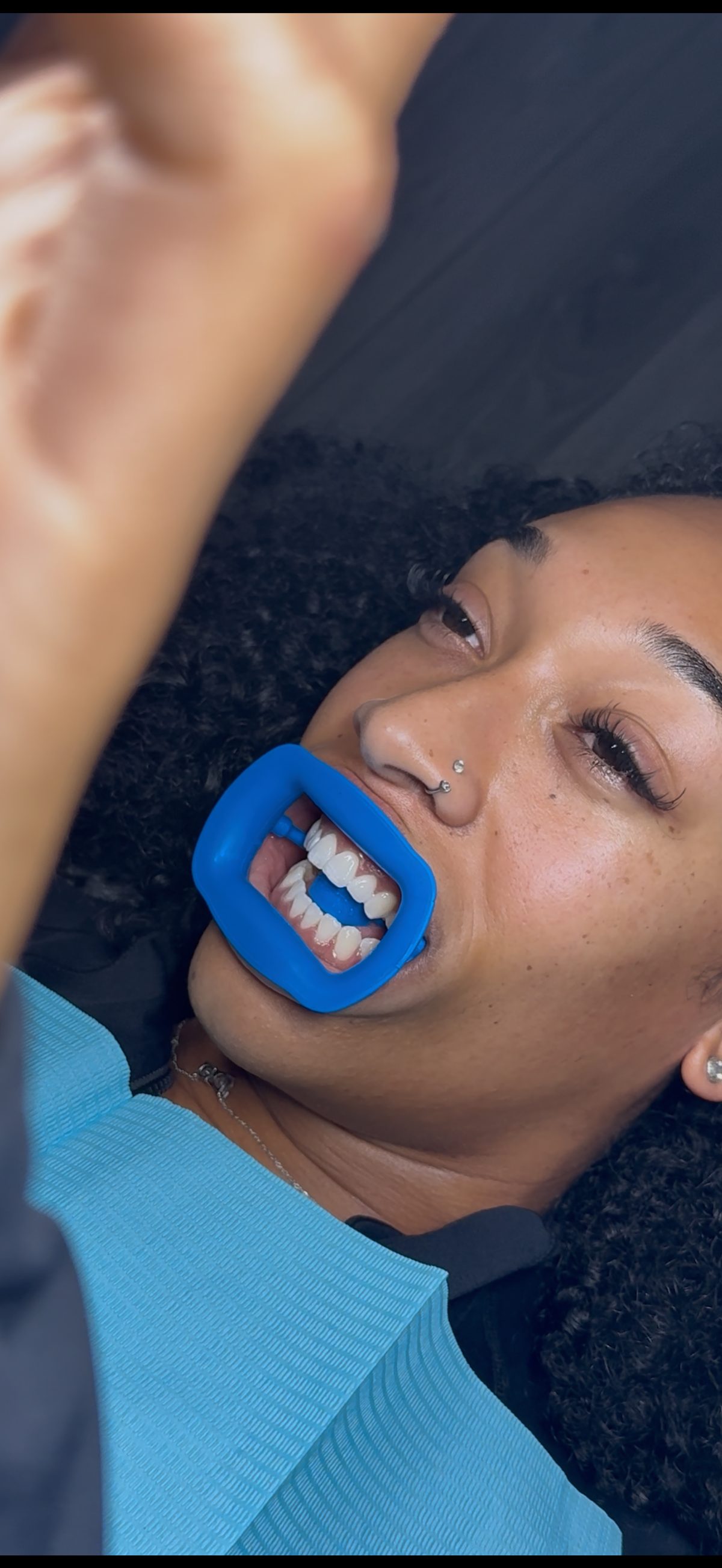 Cosmetic Teeth Brightening